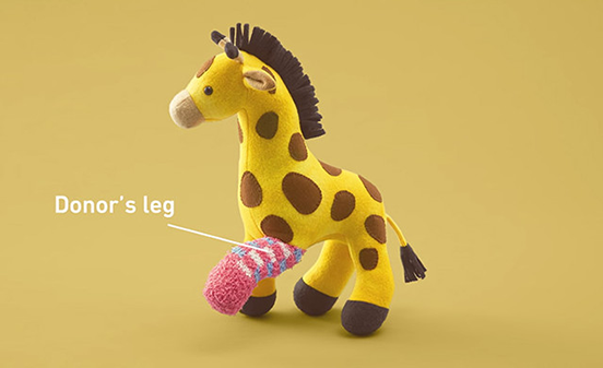 Donor’s Leg